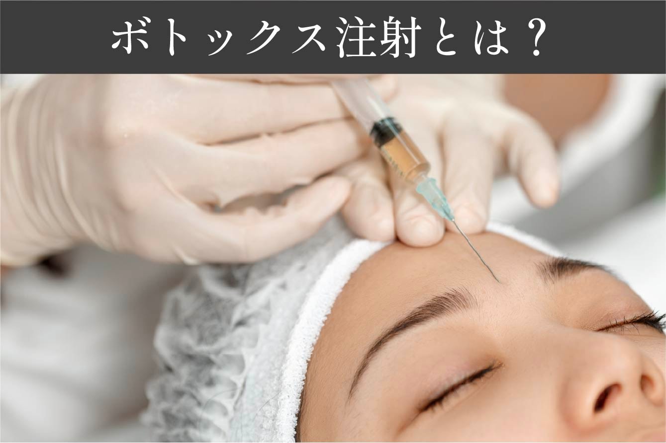 ボトックス注射とは