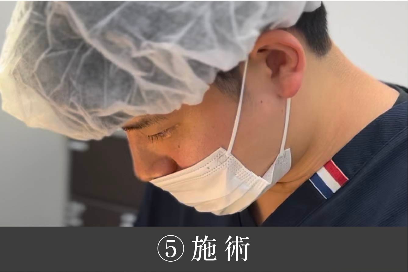 ⑤施術