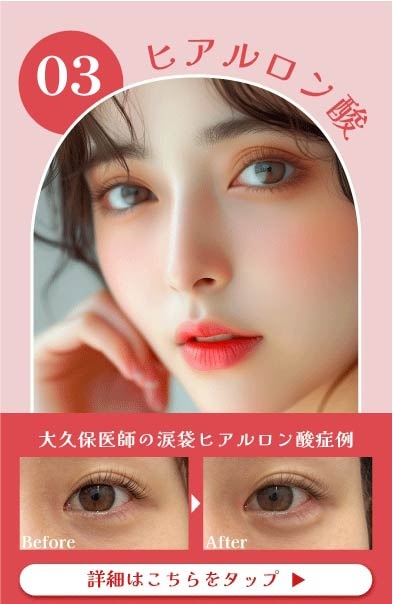【ヒアルロン酸】これ一つでシワやハリ・肌質改善が叶います！