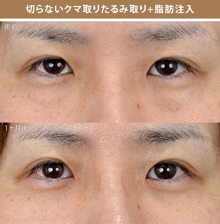 症例写真②
