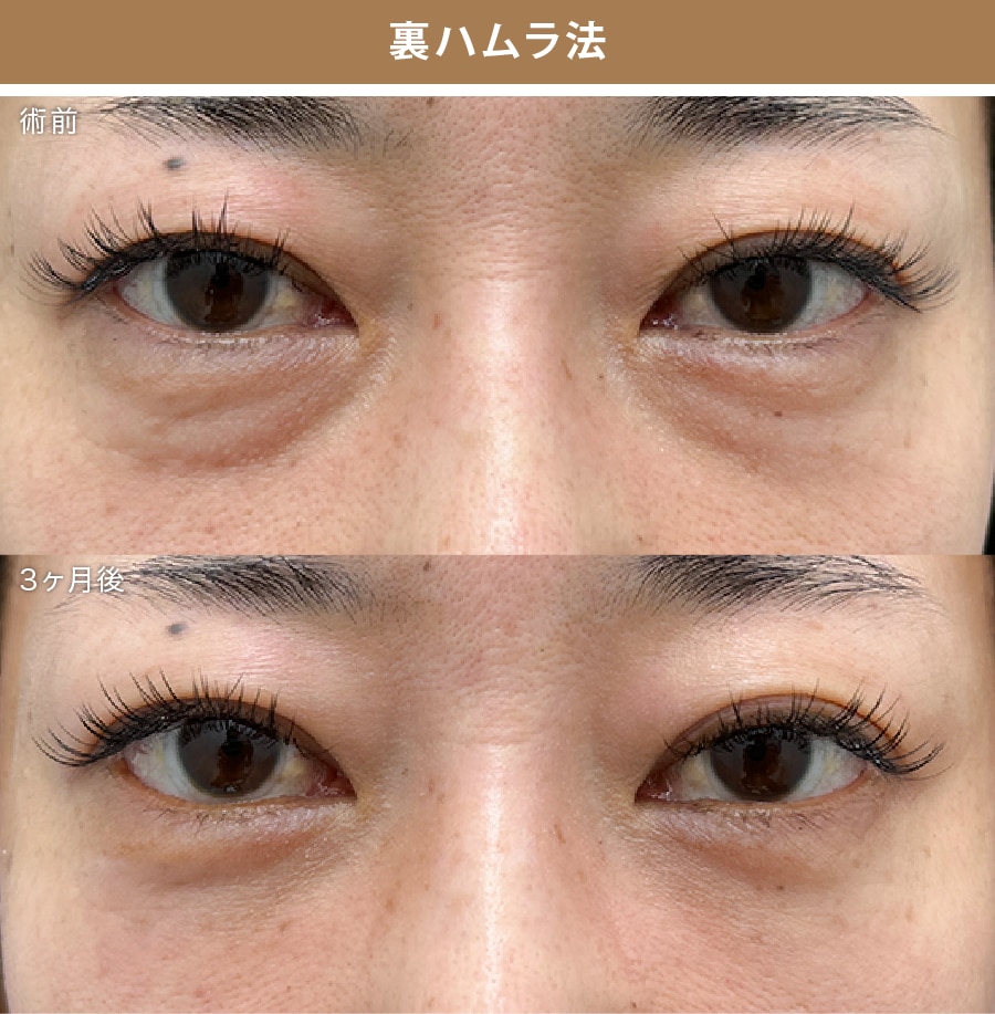 症例写真③