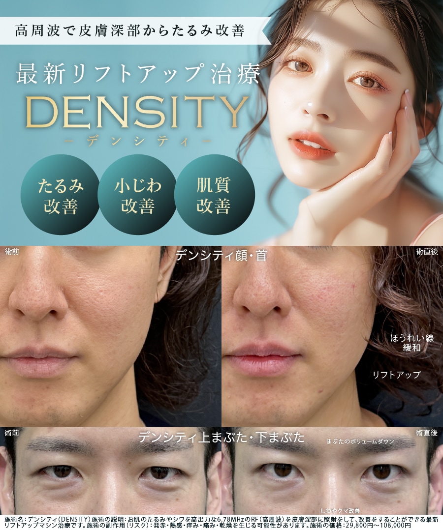 高周波で皮膚の奥深くからたるみ改善