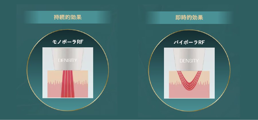 ①特許取得の「モノバイ技術」