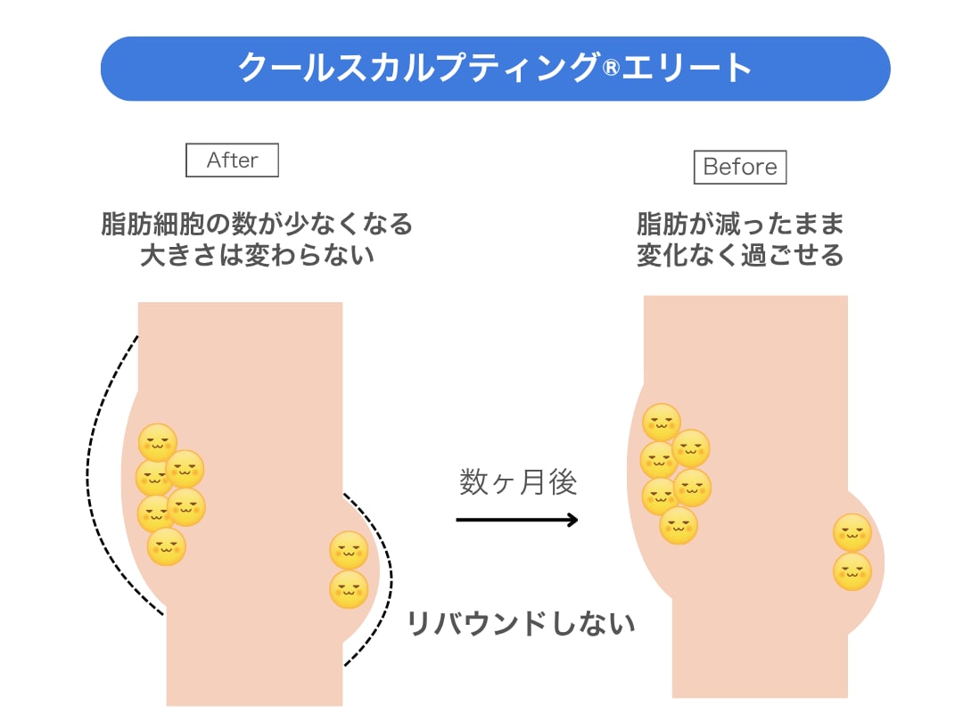 DOUSHITE2：クルスカダブルのダイエット