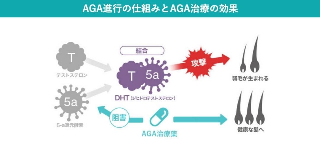 薬剤治療