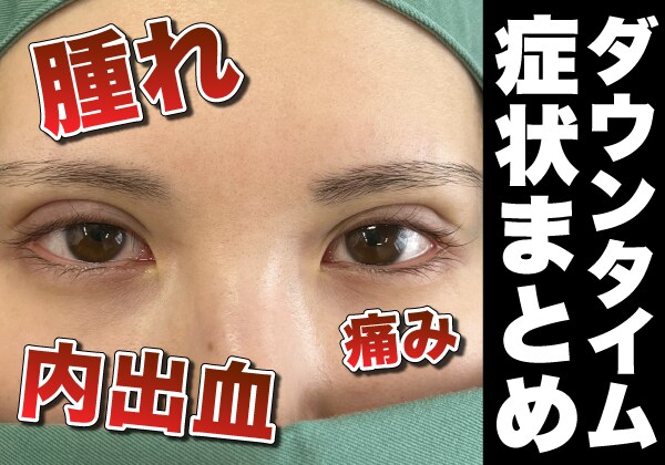 二重整形のダウンタイムはどんな症状が出る？気になる症状を術前にチェック！【千葉センシティ院】