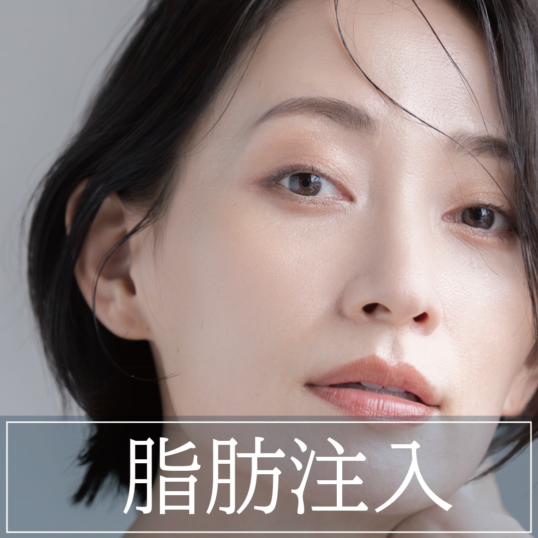 【自然な若返り】ご自身の脂肪をお顔全体に注入することで、ふっくらとした若々しい印象に
