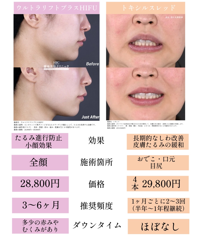 価格や効果、ダウンタイム等を比較しやすい表にまとめました♪