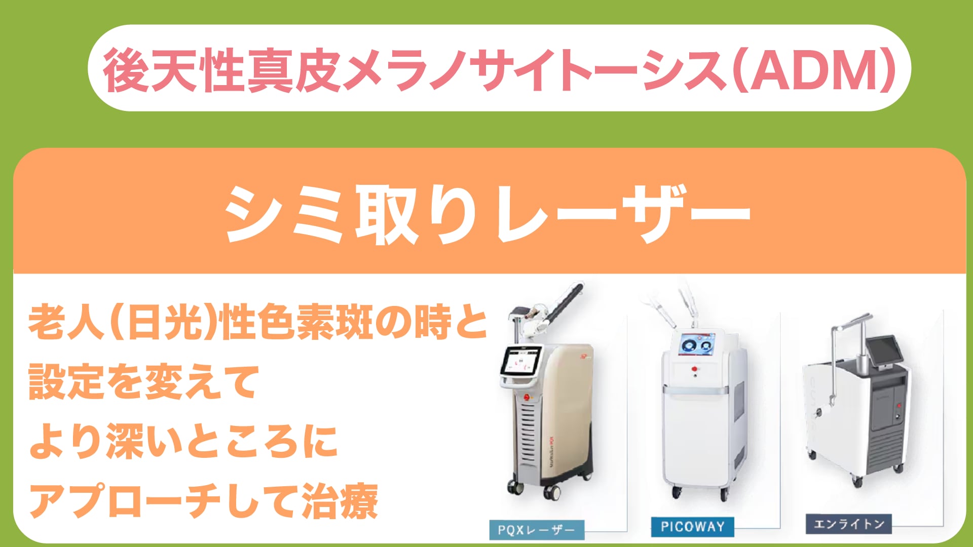 ADMの治療法｜深い層への複数回レーザー治療