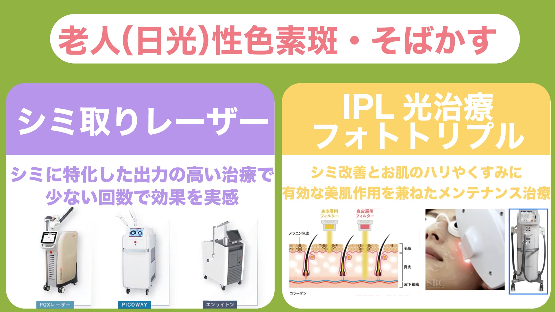老人性色素斑・そばかすの治療法｜レーザーとIPL光治療