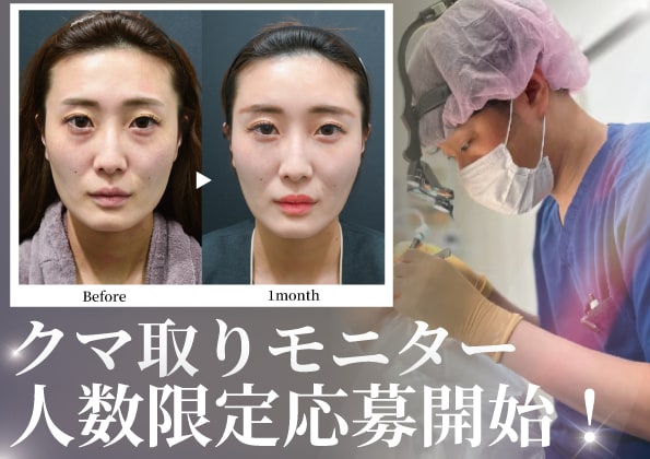 【半額顔出しモニター】【35歳から55歳限定】若返れるクマモニター募集スタート！