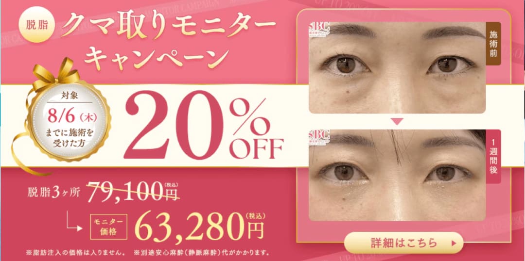 8月6日まで開催20％OFF「クマ取り」
