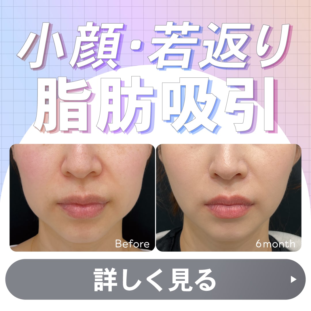 脂肪吸引・脂肪吸引注射なら湘南美容クリニック江坂院