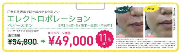 エレクトロポレーション ベビースキン【11% OFF】