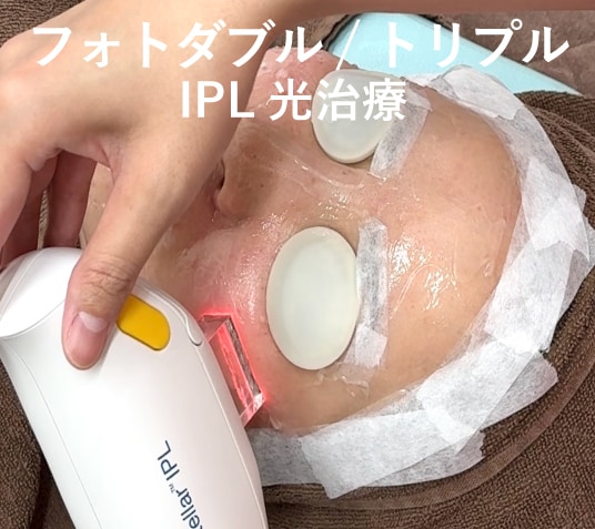💡フォトダブル / フォトトリプル（IPL光治療）の効果