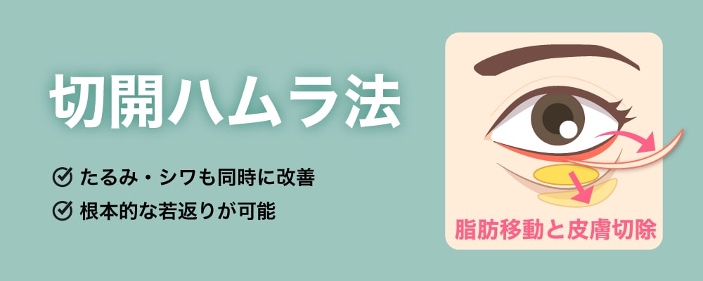切開ハムラ法
