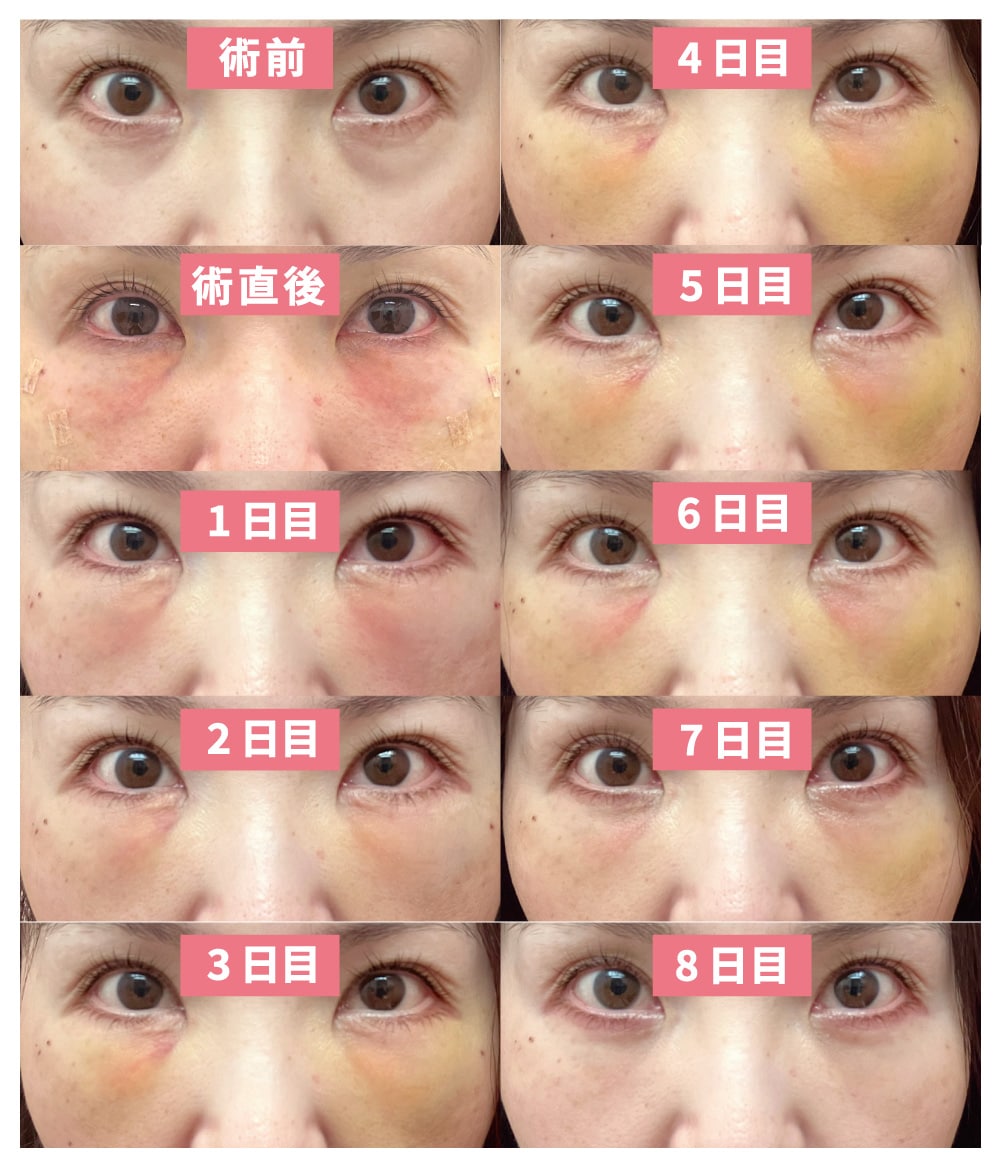 ダウンタイムはどのくらいですか？