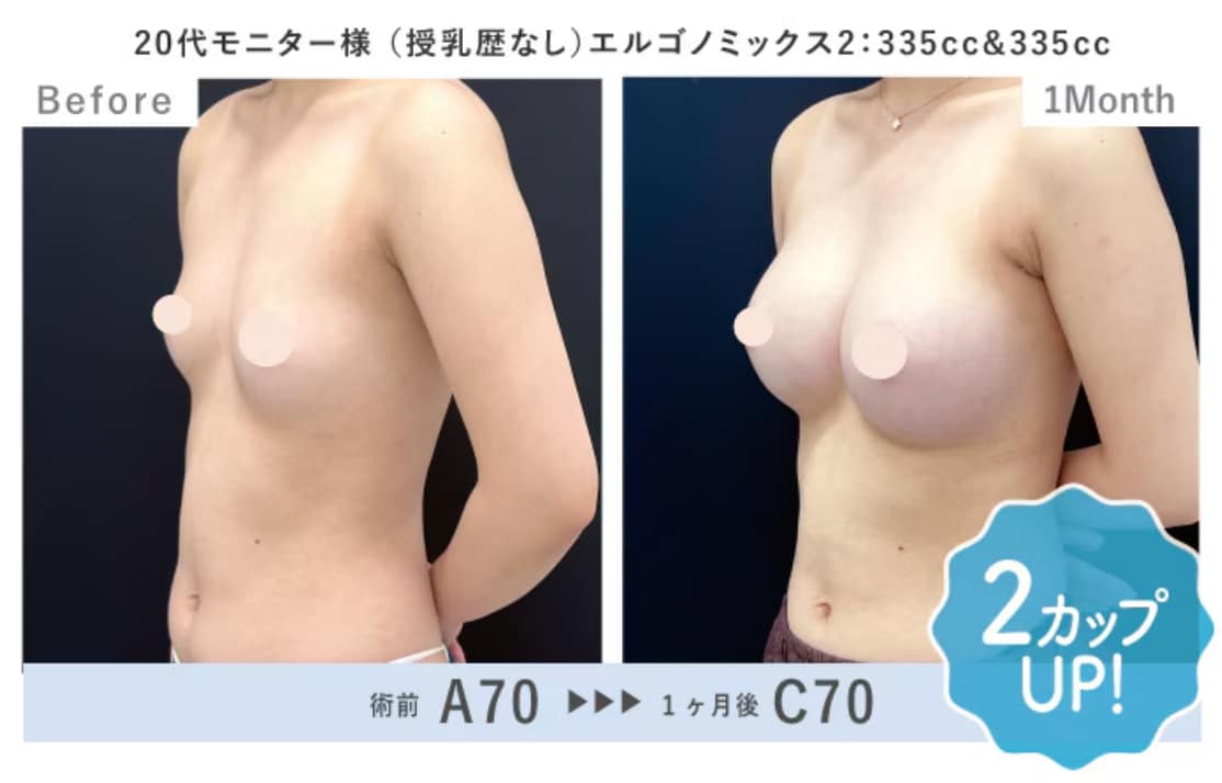 【福岡｜豊胸おすすめ】脂肪注入豊胸・シリコンバッグ豊胸の名医が在籍する湘南美容クリニック福岡院！