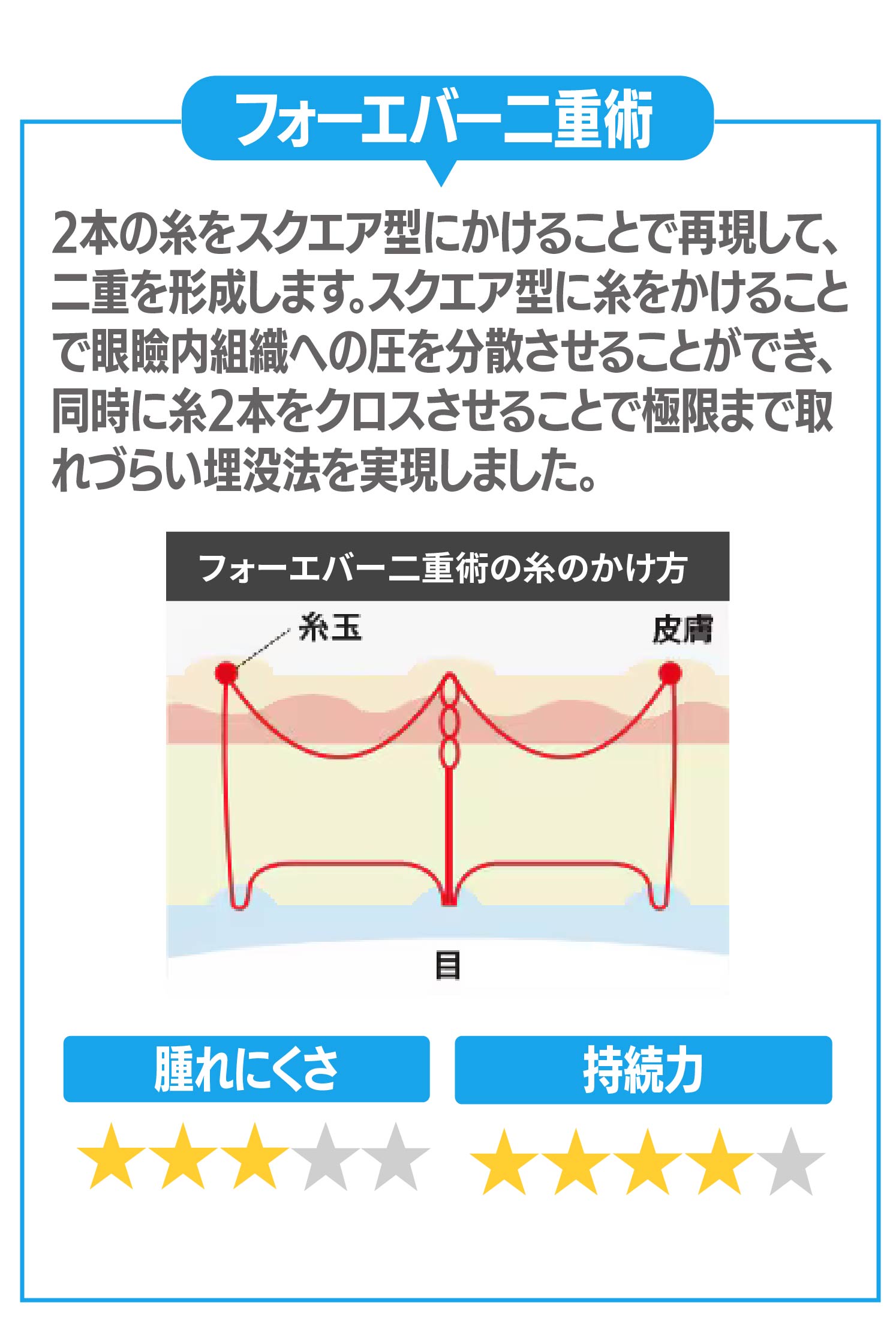 ②フォーエバー二重術について