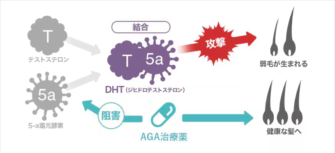 大きくわけて3つ