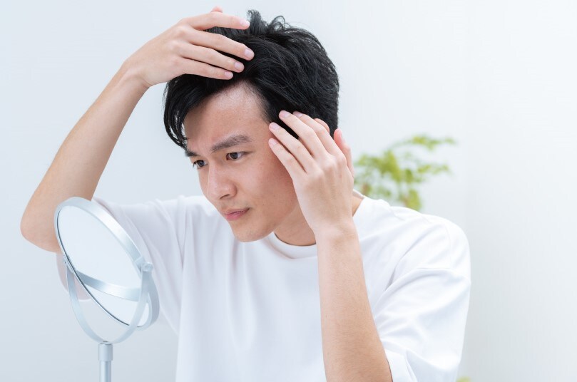 「男性型脱毛症」のこと