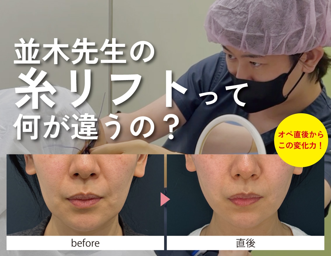福島で話題！並木先生の糸リフトが選ばれる理由｜たるみ・もたつき改善術