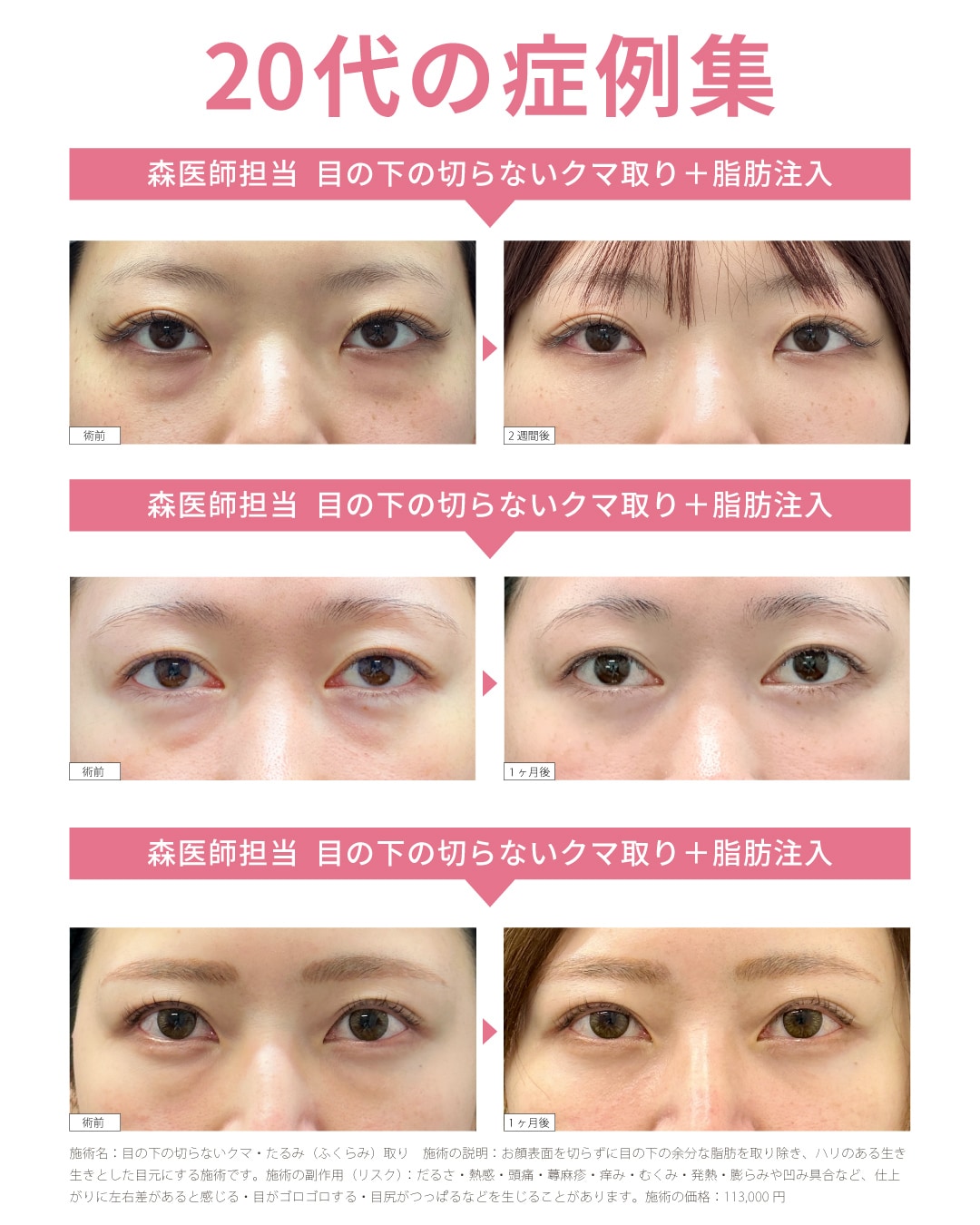 傷跡へのケアを徹底するSBC中四国唯一の形成外科専門医が担当するから美しい😍