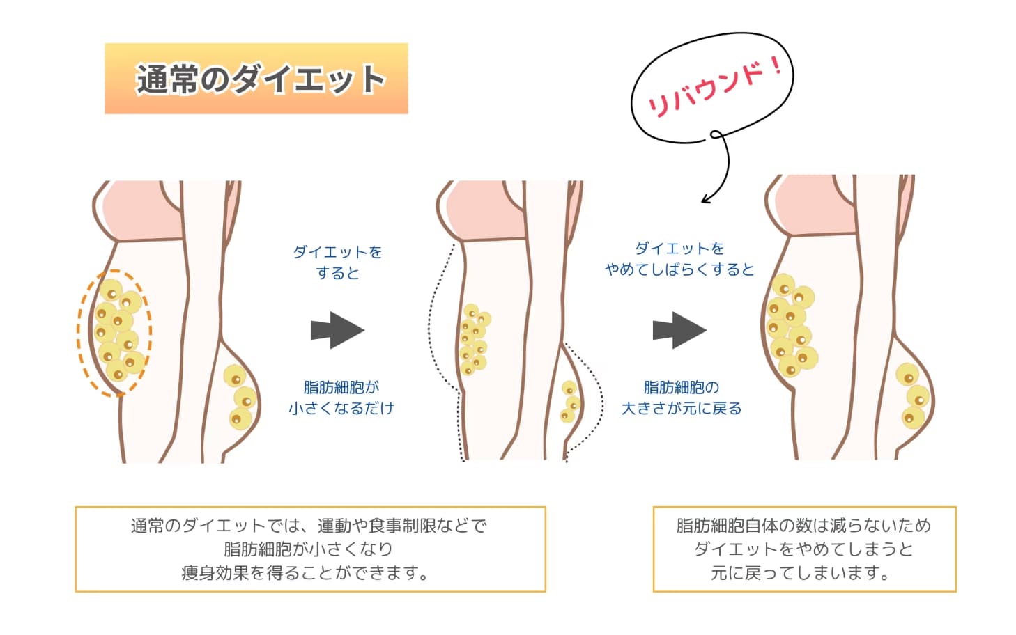 通常のダイエットとは根本から違うので、部分痩せした後もリバウンドしません！
