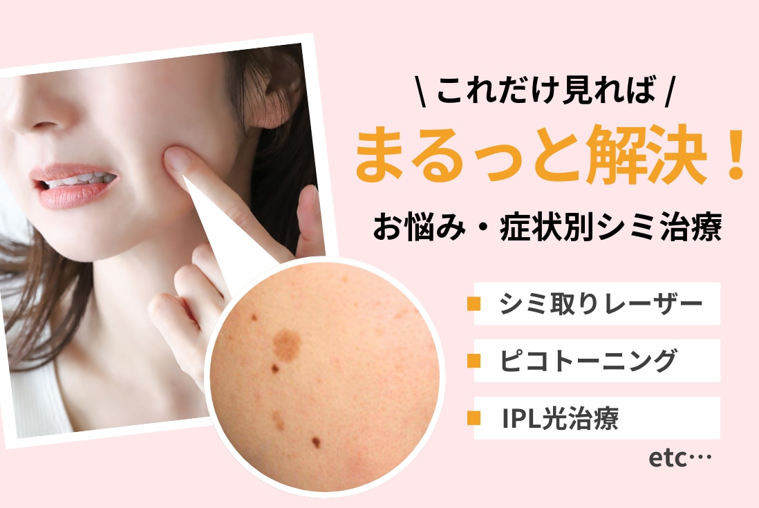 これだけ見ればまるっと解決！SBC福山院でお悩みごとにピッタリのシミ取りを♪