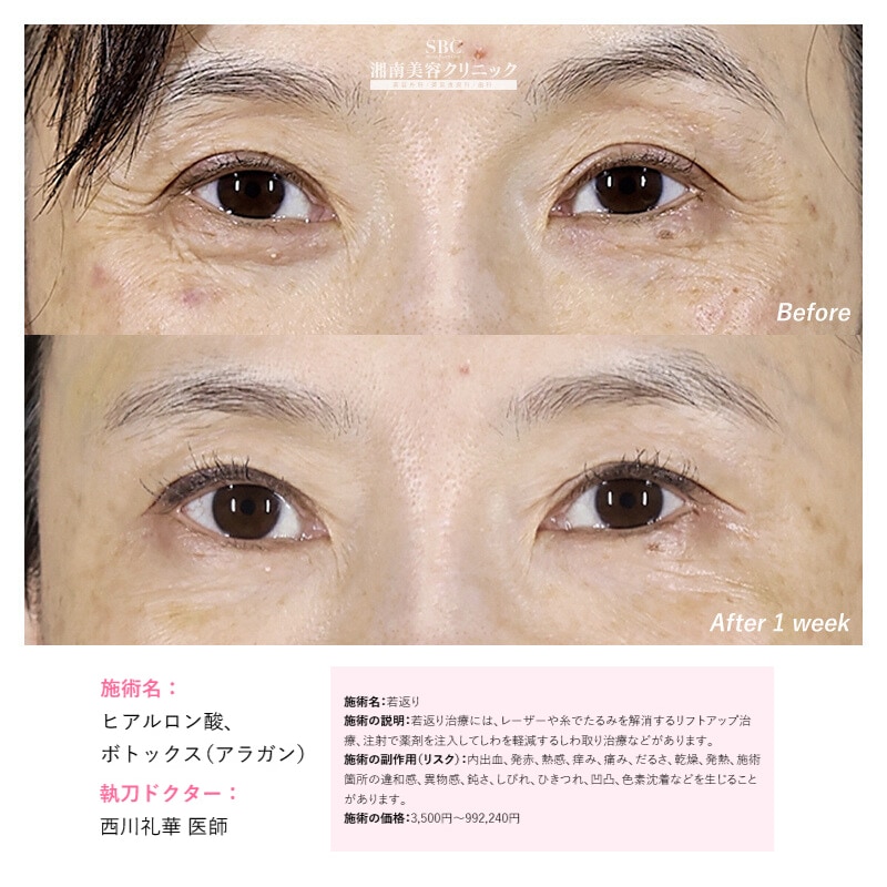 RHA1は、こんなお悩みをお持ちの方におすすめです