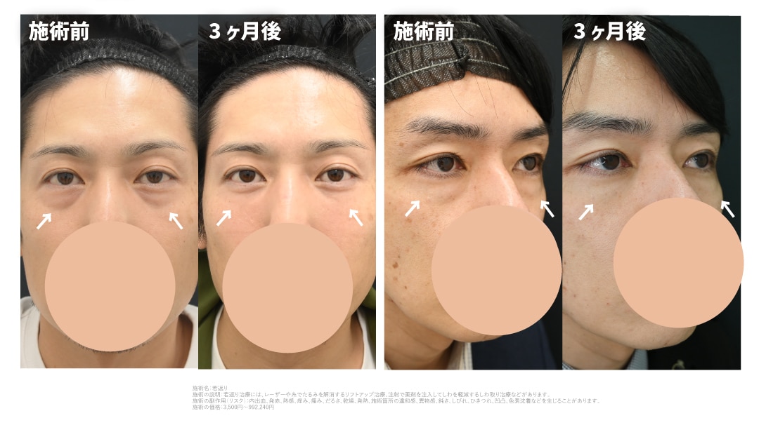 40代