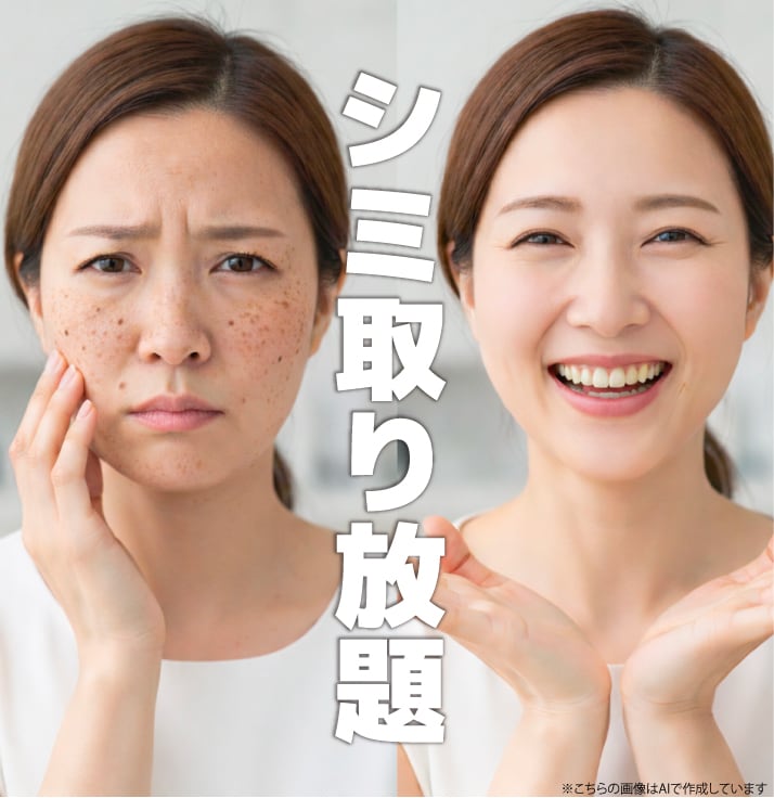 【2026年最新】船橋でシミ取りなら湘南美容クリニック|おすすめのレーザー治療と取り放題プラン(10個)を徹底解説