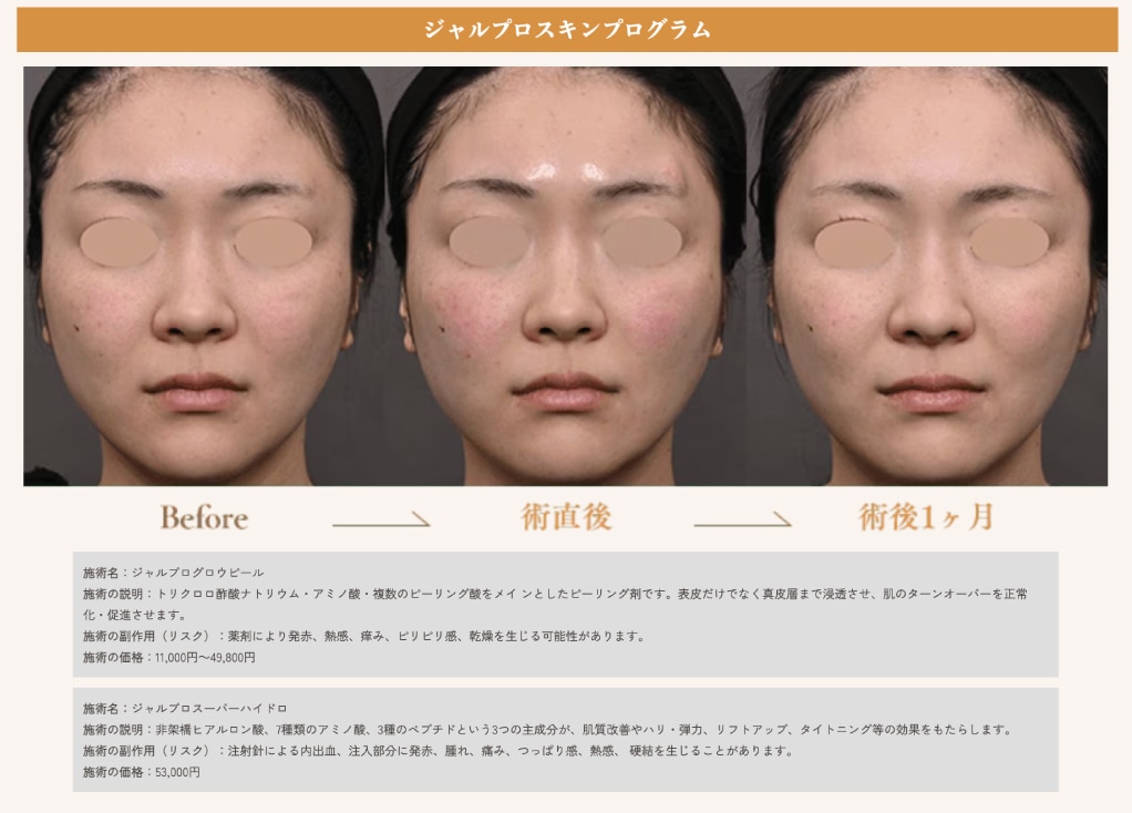 症例写真