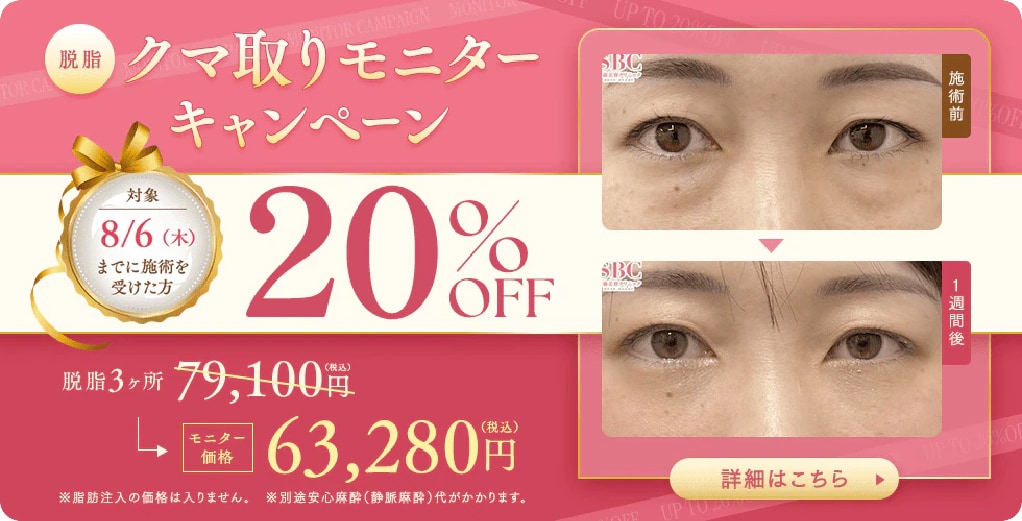 クマ取り20%OFF | 湘南美容クリニック船橋院
