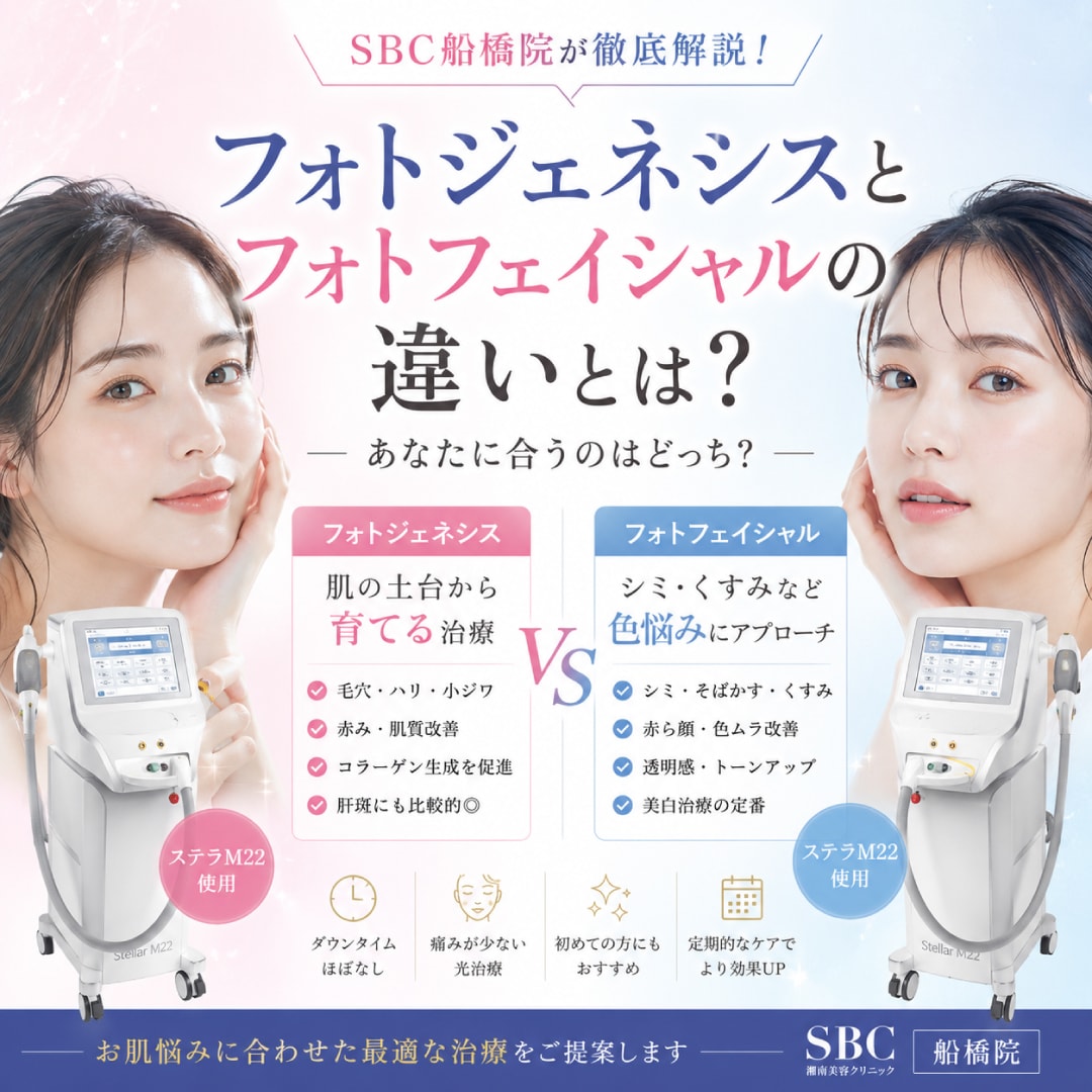 フォトジェネシスとフォトフェイシャルIPL（ステラM22）の違いとは？｜SBC船橋院が徹底解説