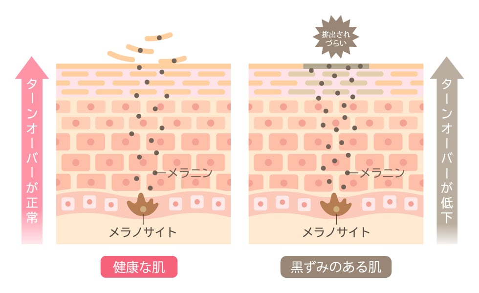 メラニンの代謝が悪くなるから