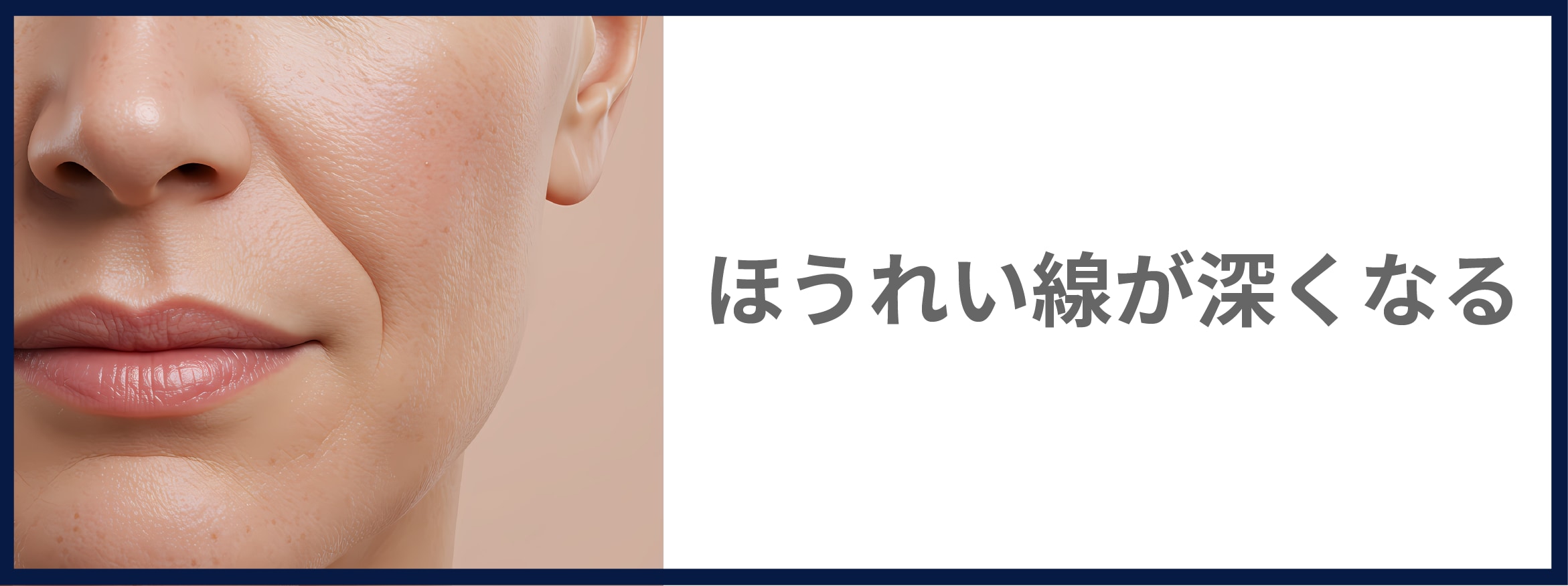 ほうれい線が深くなる