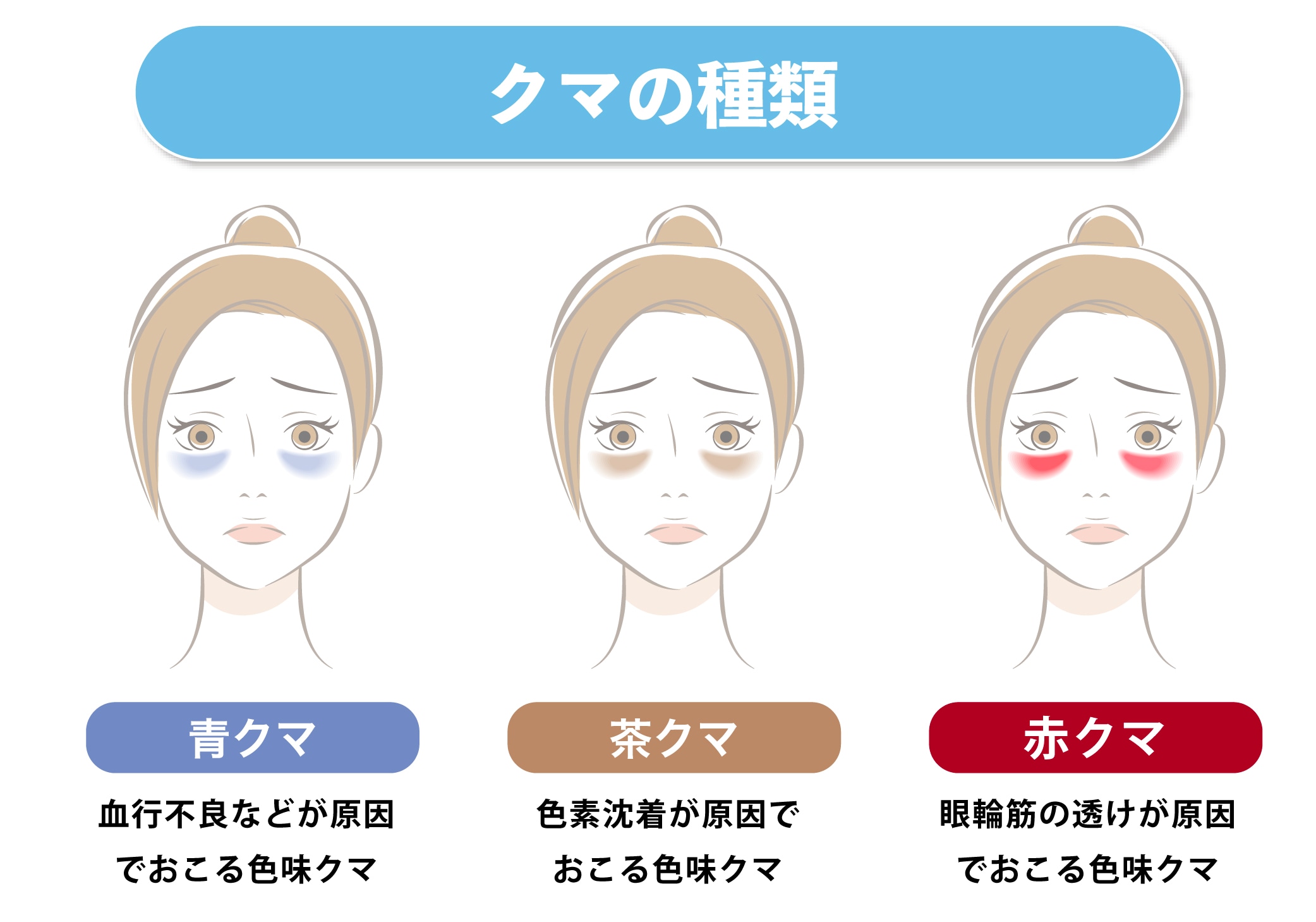 クマの種類を熟知！しっかりと適応を見極める！