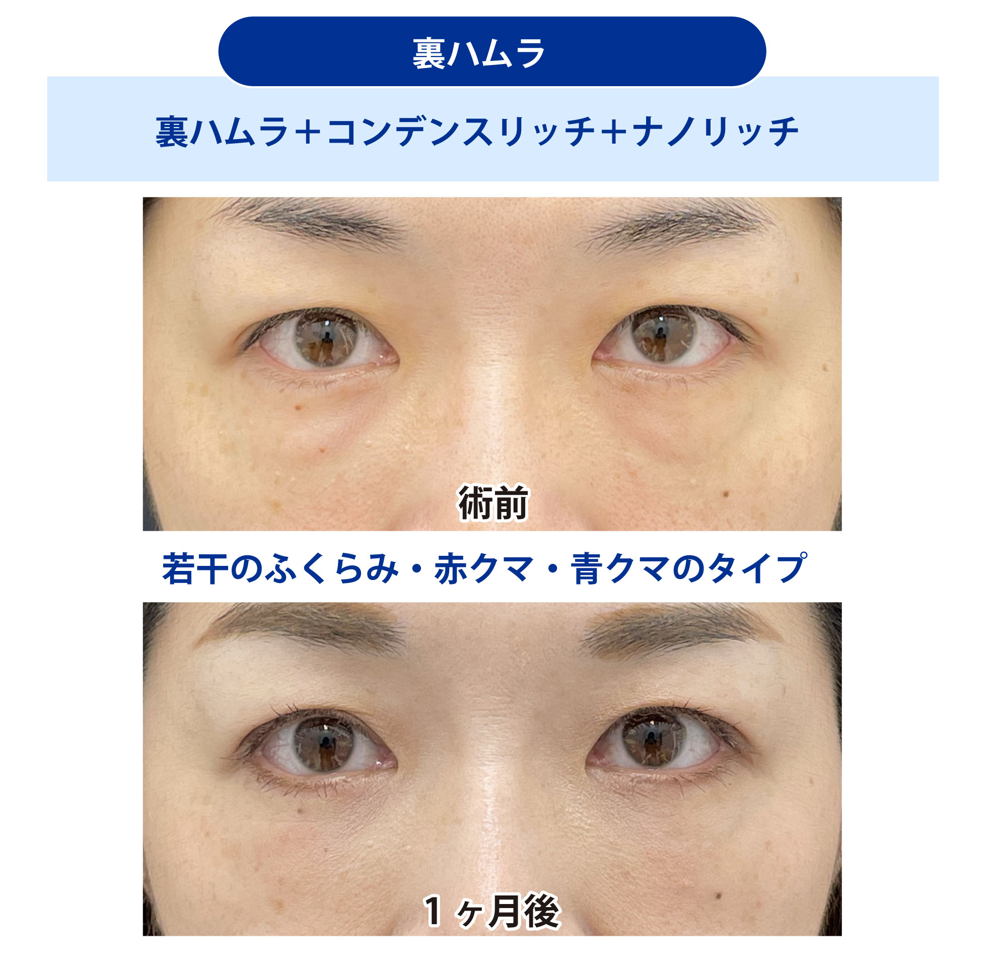 40代女性の症例写真