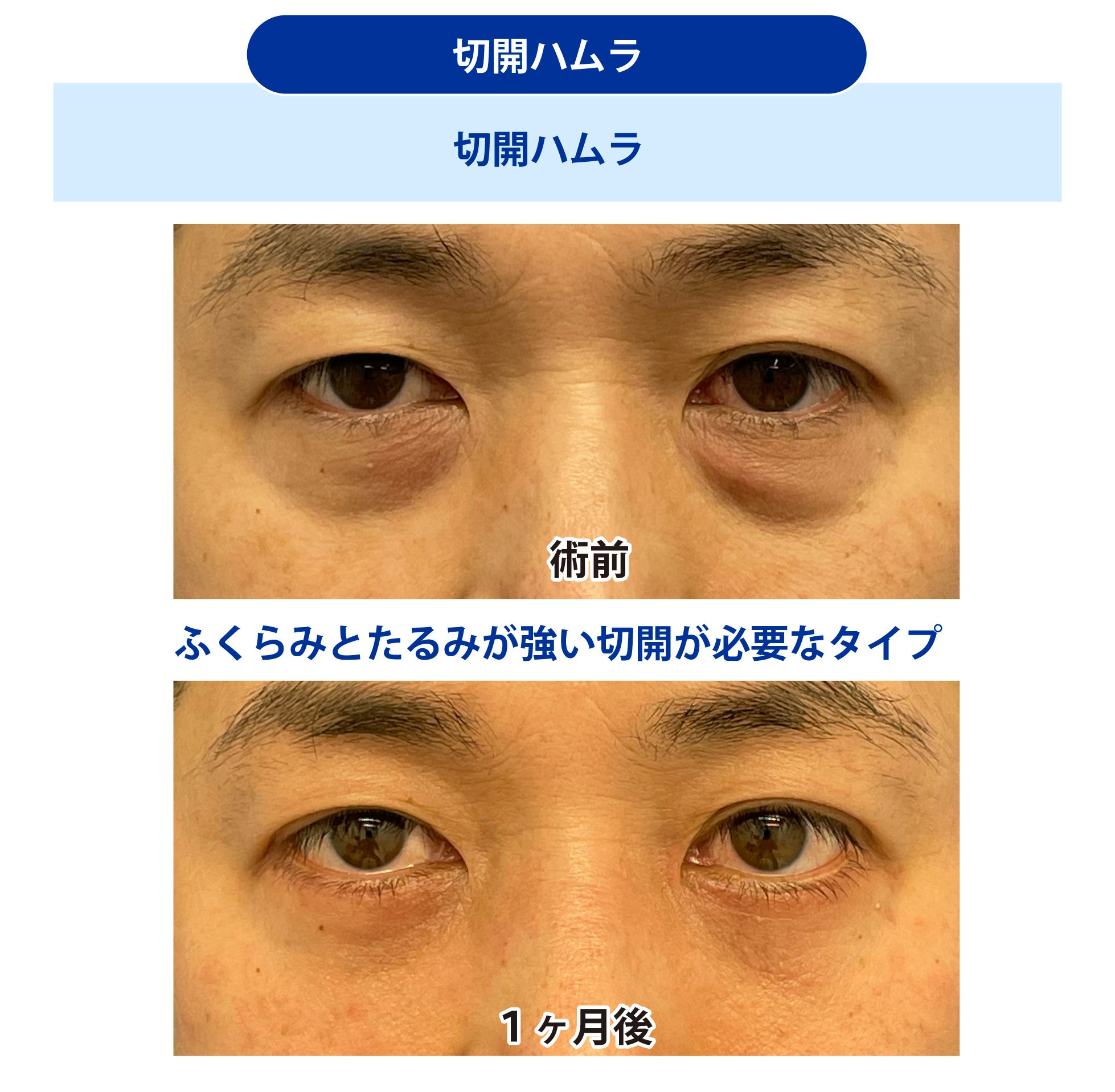 男性の症例2