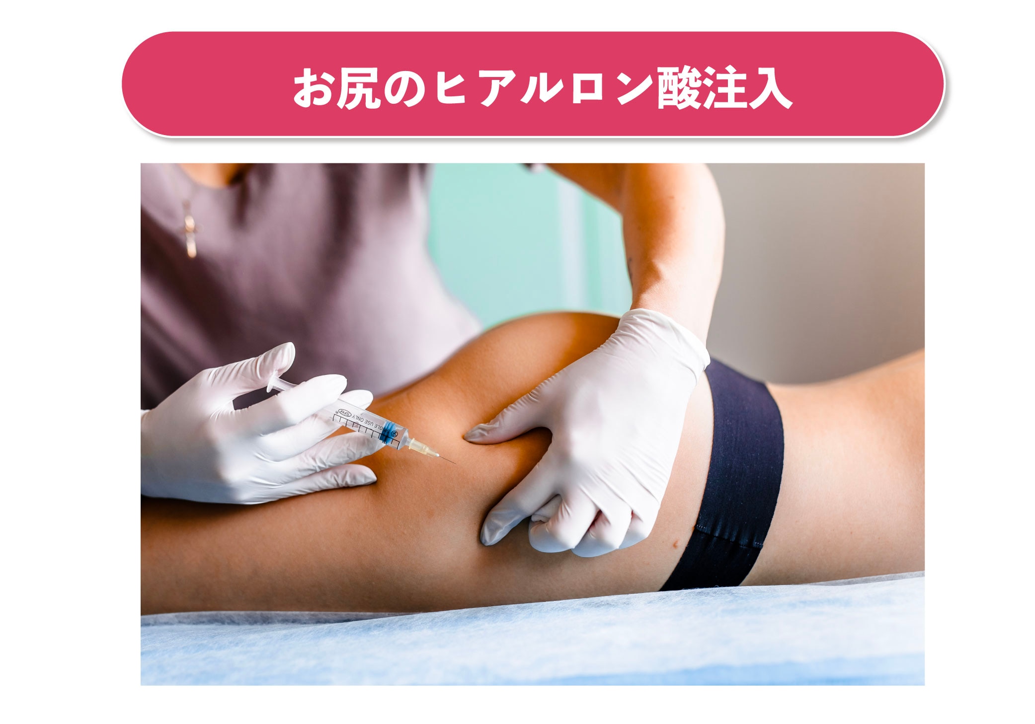 お尻のヒアルロン酸注入