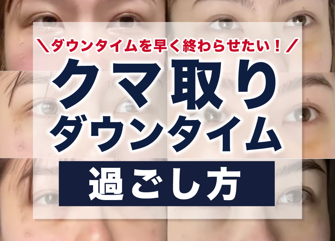 クマ取り後のダウンタイムで気をつけることや過ごし方を医師が解説！