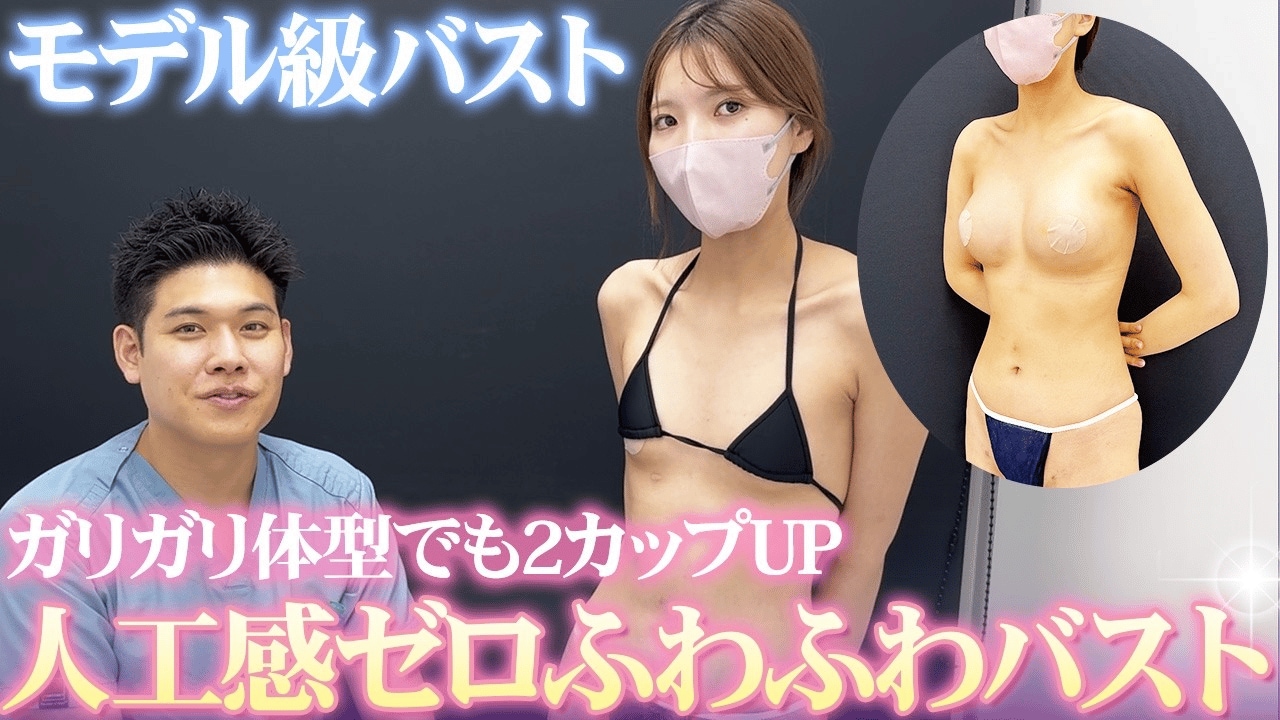 脂肪注入豊胸では満足できない？痩せ型さんにおすすめの施術を紹介！