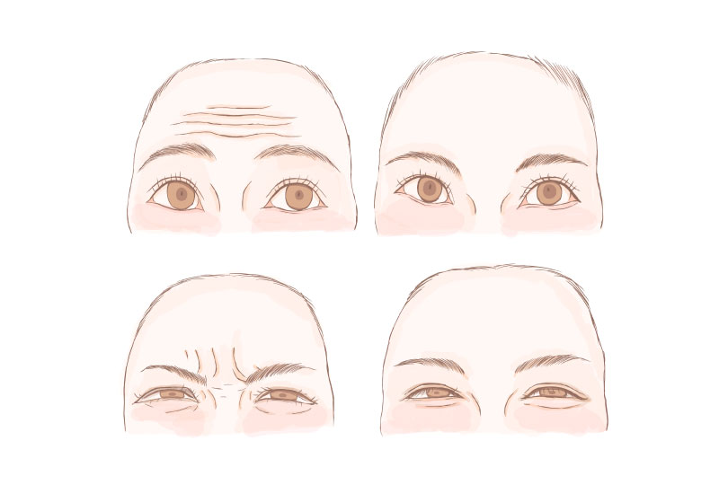 シワってそもそも何故できる？