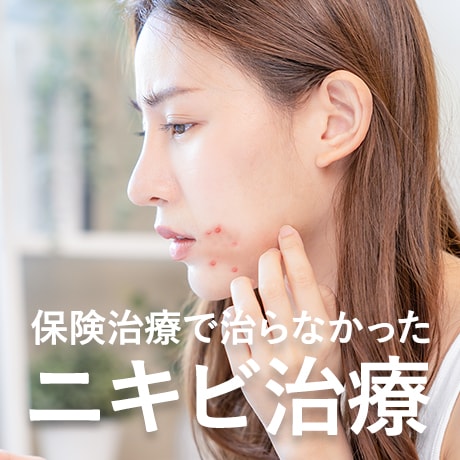 【福岡でニキビ治療】おすすめの保険治療で治らない頑固ニキビ・ニキビ跡治療!湘南美容クリニック博多院