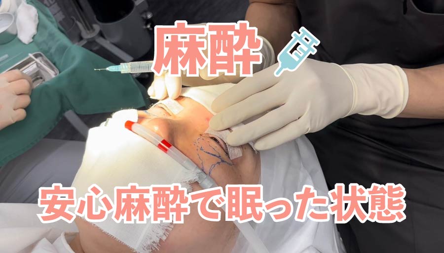 麻酔