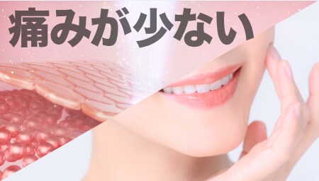 特徴 1. 痛みが少ない