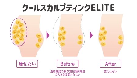 特徴 1. リバウンドしない