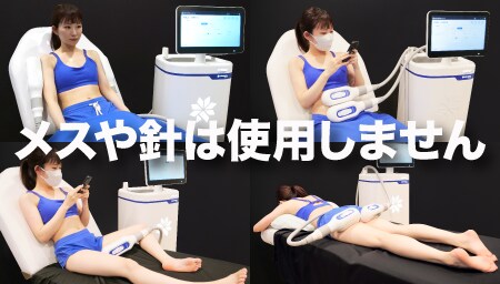 特徴 2. メスや針は使用しません