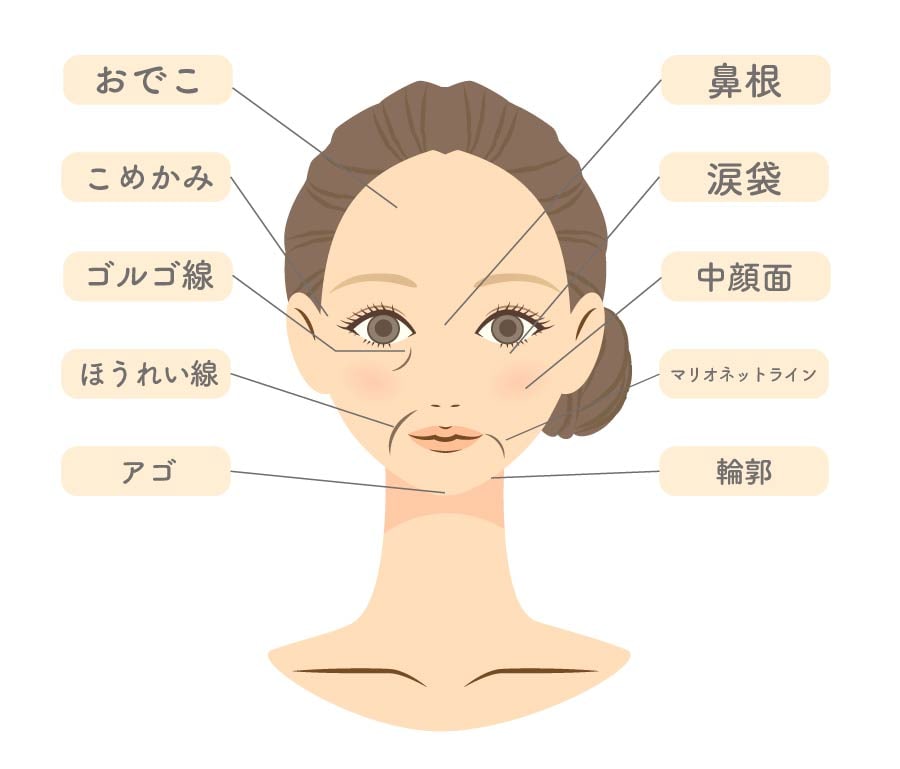 ヒアルロン酸の適応部位